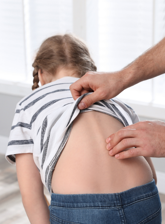 Scoliosis Adolescent