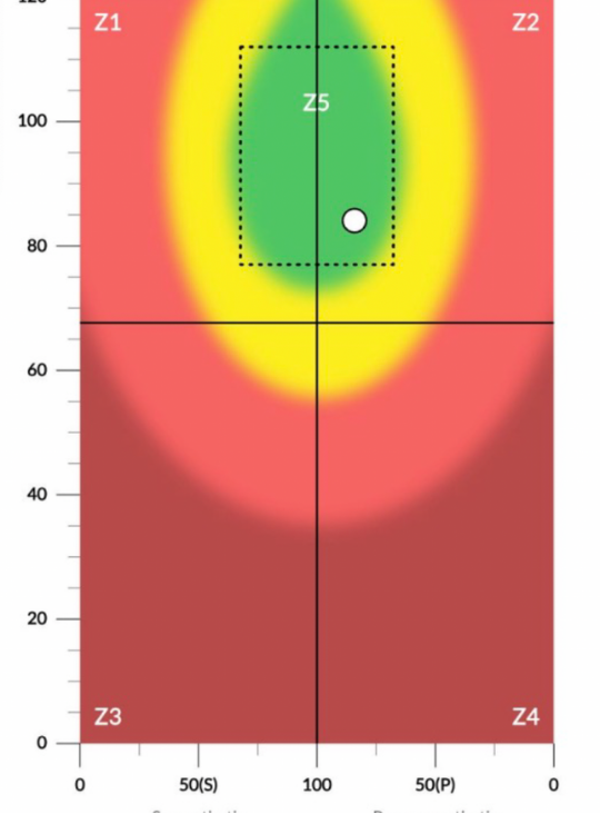 Heart Rate Variability Scane