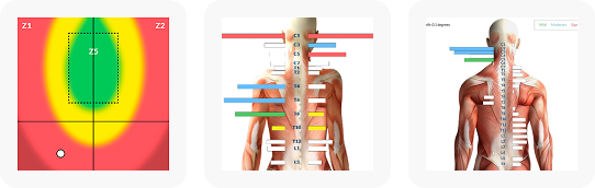 Neurological Insight scans